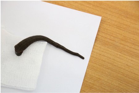 Bác sĩ 'phục' cả tiếng đồng hồ, tóm gọn con đỉa trâu bằng ngón tay người lớn