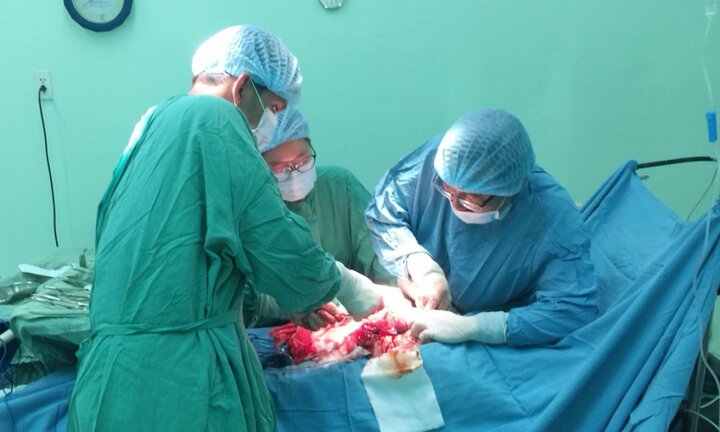 Nữ bệnh nhân ở Cần Thơ có khối u xơ tử cung khổng lồ 6kg