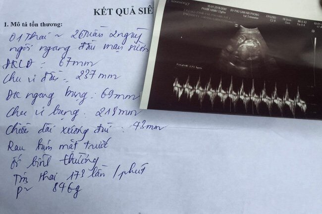 Bác sĩ ở Hải Phòng bị tố tắc trách khiến thai nhi chết lưu