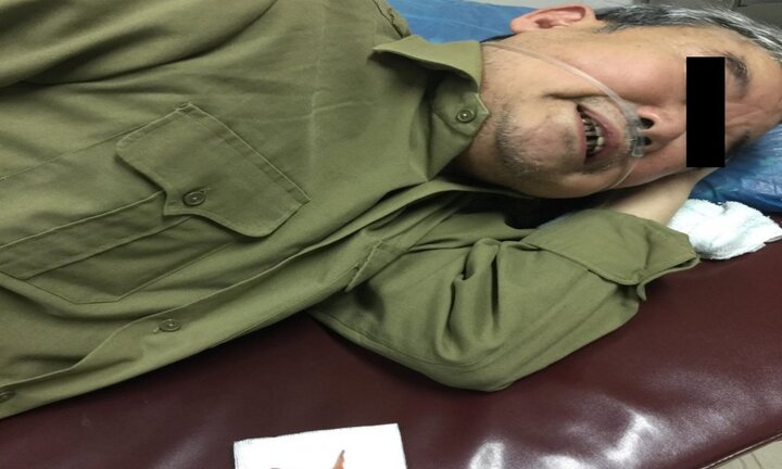 Uống thuốc, nuốt luôn cầu răng giả, bệnh nhân phải cấp cứu