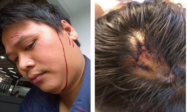 Khách hàng khiếu nại, 2 nhân viên gara ô tô lao vào hành hung