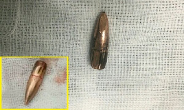 Đạn lạc 5 lần trong 4 tháng ở Vĩnh Phúc: Người già, trẻ nhỏ thương nặng