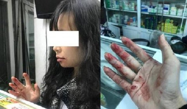 Nữ hành khách bị tài xế hành hung, nhắn tin đe doạ: Công an vào cuộc điều tra