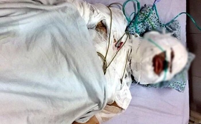 Cô gái bị kẻ lạ mặt đổ xăng thiêu sống trong tiệm may ở Hà Nội