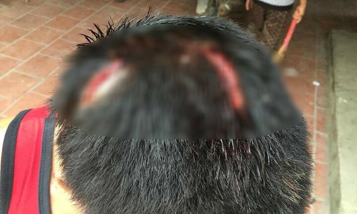 Người đàn ông bị 2 kẻ côn đồ bắt quỳ lạy, dùng hung khí đánh dã man ở Bắc Giang