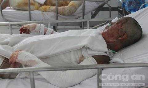 Cô gái bị người tình tưới xăng đốt giữa Sài Gòn đã không qua khỏi