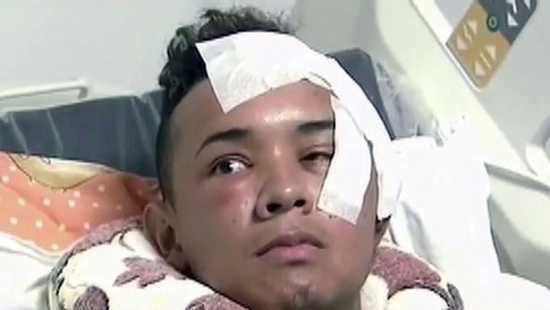 Người đàn ông bị dao đâm xuyên mắt được cứu sống ngoạn mục