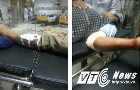 Quay cảnh 2 người cãi nhau, nam thanh niên bị hành hung dã man