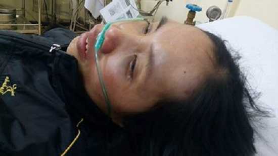 Anh họ đánh em gái chấn thương sọ não