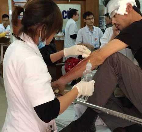 Gần 2.000 ca cấp cứu do đánh nhau trong hai ngày Tết