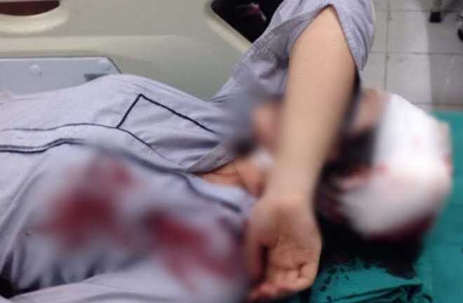 Nữ sinh lớp 10 bị bạn dùng gậy sắt đánh nhập viện