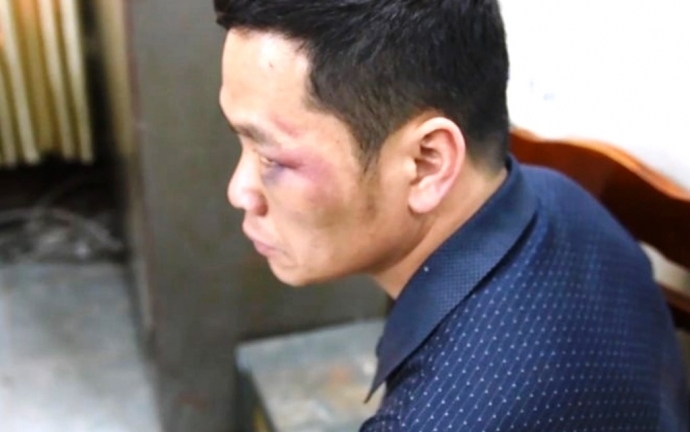 Chở 100 bánh heroin, bị công an nổ súng bắt giữ: Tài xế khai gì?