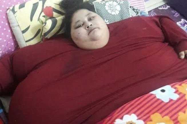 Người phụ nữ nặng nhất thế giới phẫu thuật giảm cân sau 25 năm nằm một chỗ