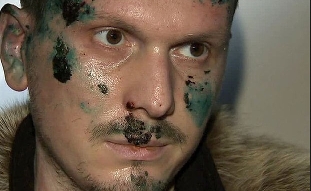 Kẻ định tấn công Tổng thống Putin bị bắn trọng thương