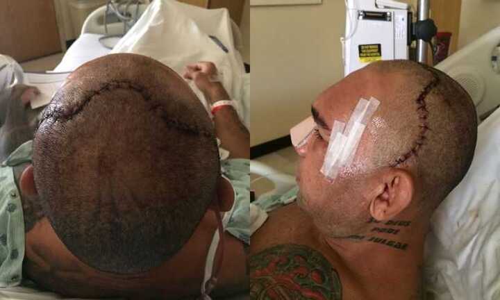 Rợn người hình ảnh võ sỹ nứt hộp sọ sau cú lên gối tàn độc