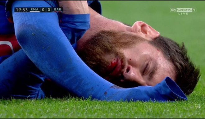 Messi nhổ ra chiếc răng bị gãy trong đường hầm Bernabeu