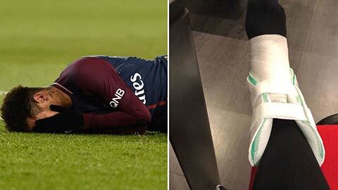 Neymar có nguy cơ nghỉ 3 tháng, chắc chắn vắng mặt trận PSG vs Real
