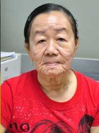 Kết luận ban đầu bệnh 'cô gái hóa bà lão' ở Bến Tre