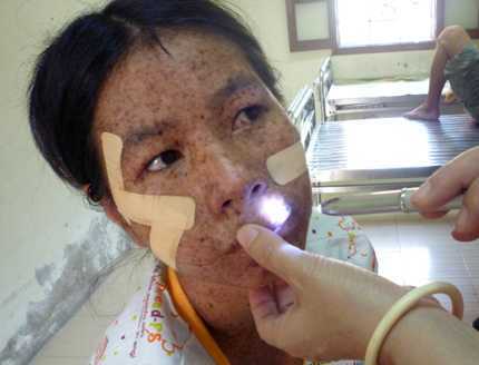 Thêm người mắc 'bệnh khủng khiếp' ở Hải Phòng