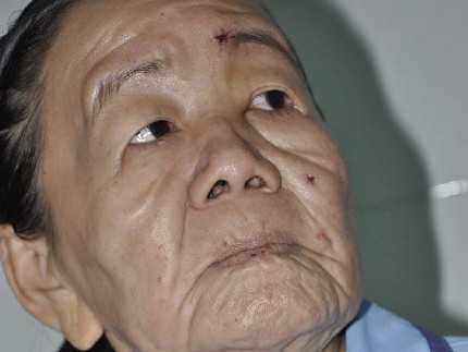 Cô gái Bến Tre hóa bà lão: Đã có kết quả từ Mỹ