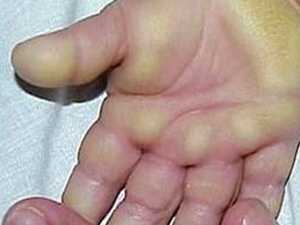 Kết luận bước đầu về căn 'bệnh lạ' ở Quảng Ngãi