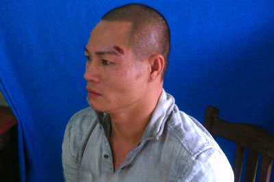 Kẻ gieo rắc bệnh tật, cái chết từ từ cho các cô gái