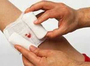 Garo không đúng cách, cắt bỏ bàn tay