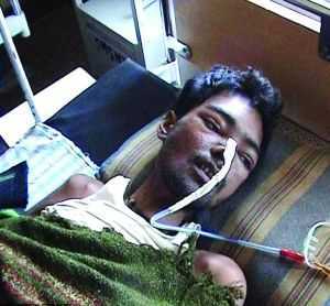 Nuốt 6kg đinh vít, chìa khóa... đến chết