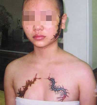 Bắt bà chủ ép thiếu nữ xăm 'quái thú' lên mặt