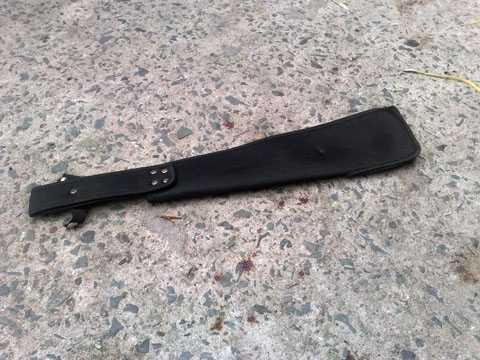 Nhậu say, cha chém con trai toác đầu