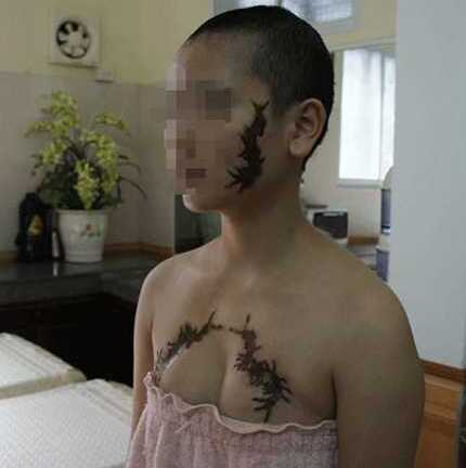 Xăm rết lên mặt thiếu nữ: “Có tiền thì tôi làm