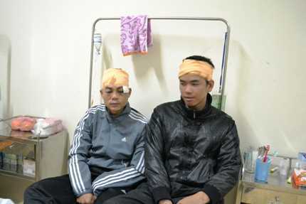 Hà Nội: Côn đồ đâm chém loạn xạ trong quán cafe