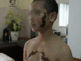 Kẻ cạo trọc đầu 'cô gái mặt rết' bị tạm giam 2 tháng