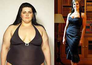 Giảm béo bằng đặt bóng hơi trong… dạ dày