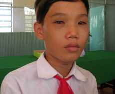 Ông đánh cháu ngoại gây thương tích nhận kiểm điểm