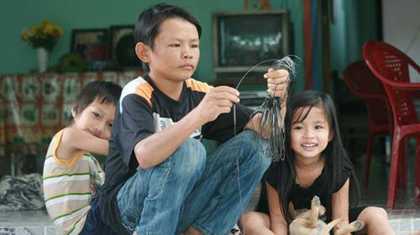 Người đàn ông mắc bệnh... trẻ mãi không già