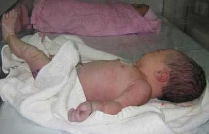 Tiểu đường khi mang thai, con chào đời nặng 6kg