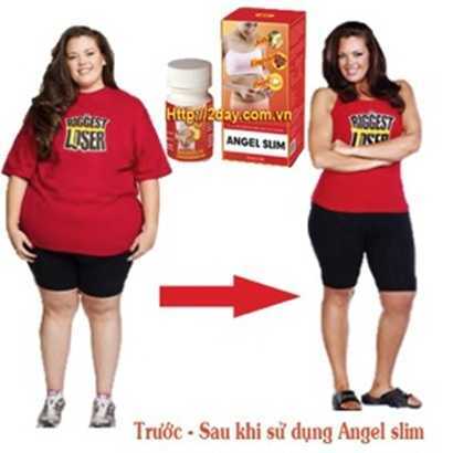 Điều trị thừa cân lâu năm bằng đột phá mới ANGEL SLIM
