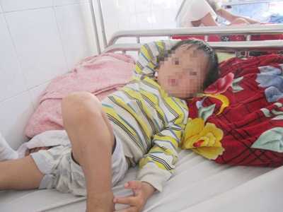 Nối thành công dương vật cháu bé 3 tuổi bị chó cắn đứt