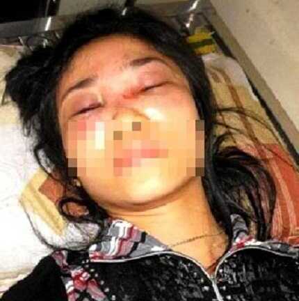 Cô giáo bị 2 kẻ lạ mặt hành hung dã man