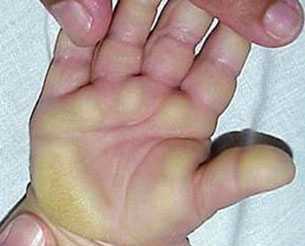 Quảng Ngãi: Lại thêm bệnh da lạ mới