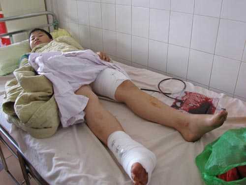 Sập phòng dạy thêm, 2 học sinh nhập viện