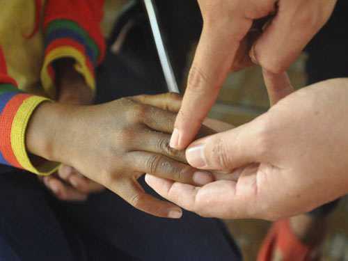 'Bệnh lạ' quái ác có nguyên nhân từ ăn gạo mốc?