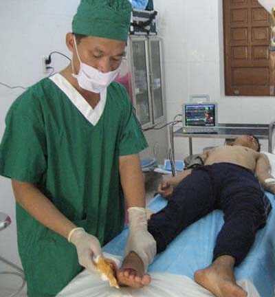 Ngư dân bị cá cờ đâm xuyên bàn chân