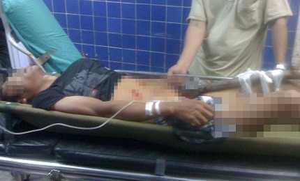 Ngã xe máy, nam thanh niên bị cây gỗ đâm thấu bụng