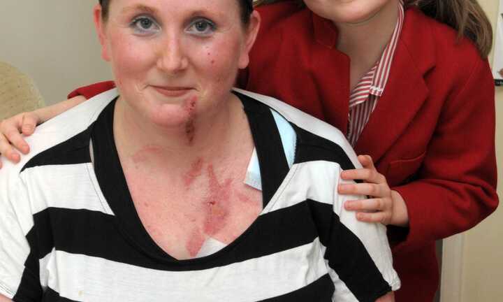 Chuyện về bé gái 8 tuổi 'dành lại' nhan sắc cho mẹ