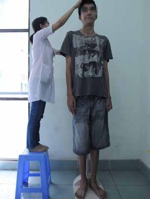 Phẫu thuật cho chàng trai 2,03m để hạn chế chiều cao