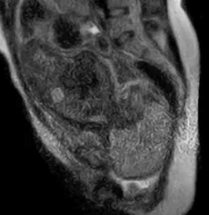 Lần đầu tiên quay được hình ảnh đứa trẻ ra đời