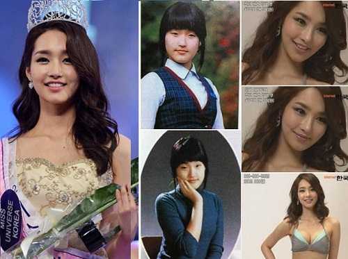 Lộ bằng chứng dao kéo của Hoa hậu Hàn Quốc 2012