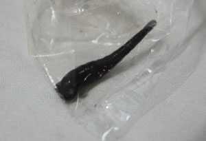 Con vắt dài gần 5cm trong khí quản bé 6 tuổi